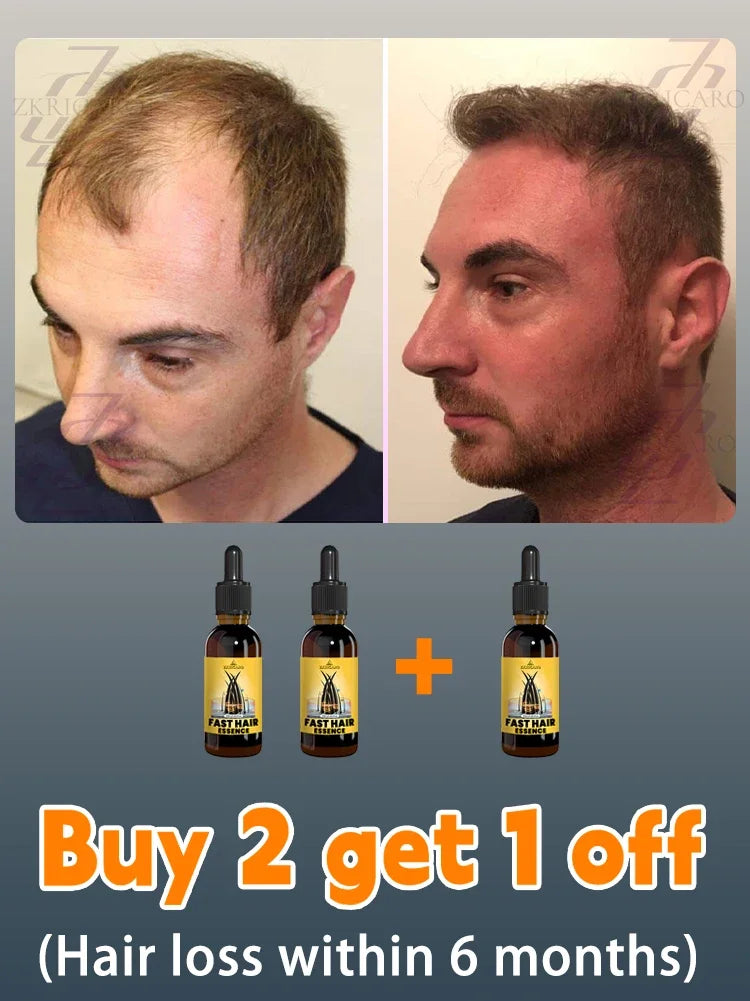 hair growth oil, Repair baldness, hairline, seborrheic alopecia hair care fast shipping hair oil