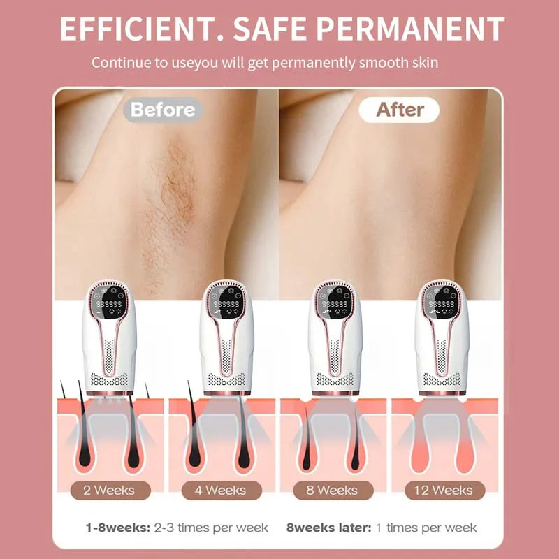 Best Remover Machine Face Germany Diode Appliance Remove Home Machines Facial Price Epilator Gel for Laser Hair Removal