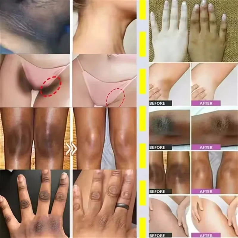 Body Whitening Soap Underarm Knee Bleaching Soap Chicken Skin Removal Dark Spot Removal Dead Skin Moisturize Brighten Body Care