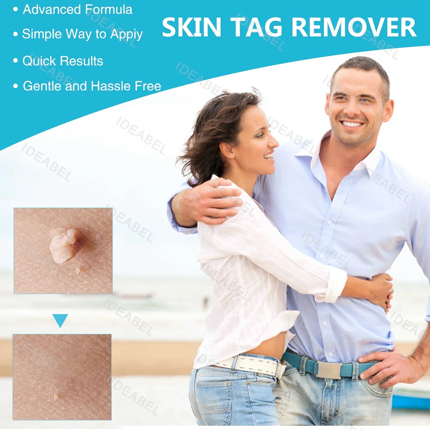 3 IN 1 Auto Micro Skin Tag Remover Device Standard And Micro Skin Tag Removal Kit Adult Mole Wart Remover Face Care Beauty Tools