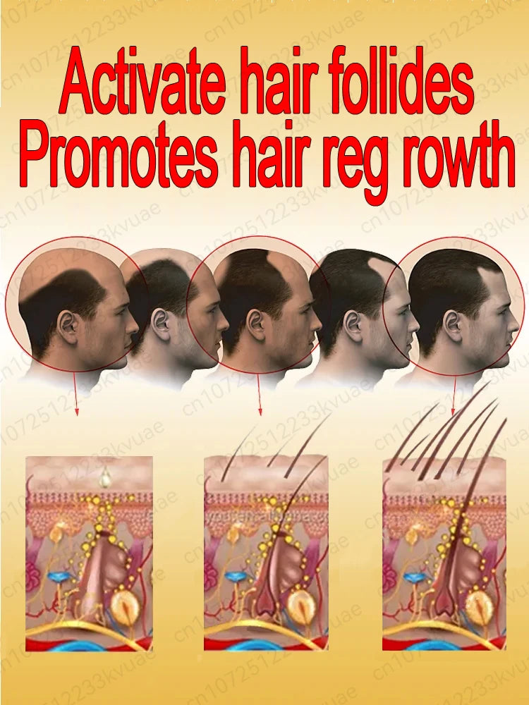 hair growth oil, Repair baldness, hairline, seborrheic alopecia hair care  fast shipping  hair oil