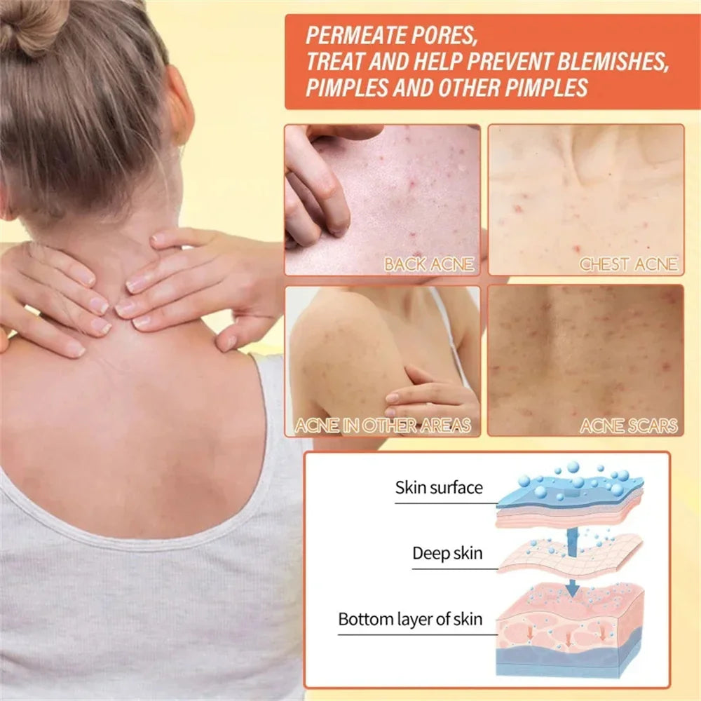 Body Whitening Soap Underarm Knee Bleaching Soap Chicken Skin Removal Dark Spot Removal Dead Skin Moisturize Brighten Body Care