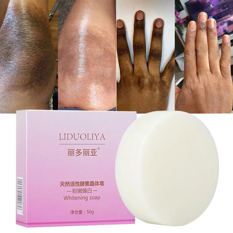 Body Whitening Soap Underarm Knee Bleaching Soap Chicken Skin Removal Dark Spot Removal Dead Skin Moisturize Brighten Body Care