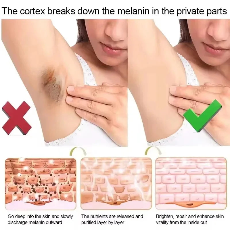 Body Whitening Soap Underarm Knee Bleaching Soap Chicken Skin Removal Dark Spot Removal Dead Skin Moisturize Brighten Body Care