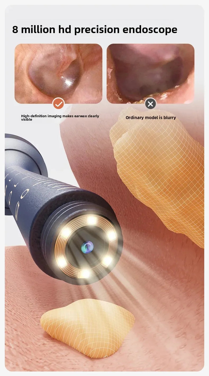 Smart Visual Ear Wax Cleaner with HD Camera Endoscope Wireless WiFi Ear Cleaning Tool for Home Use Ear Wax Remover