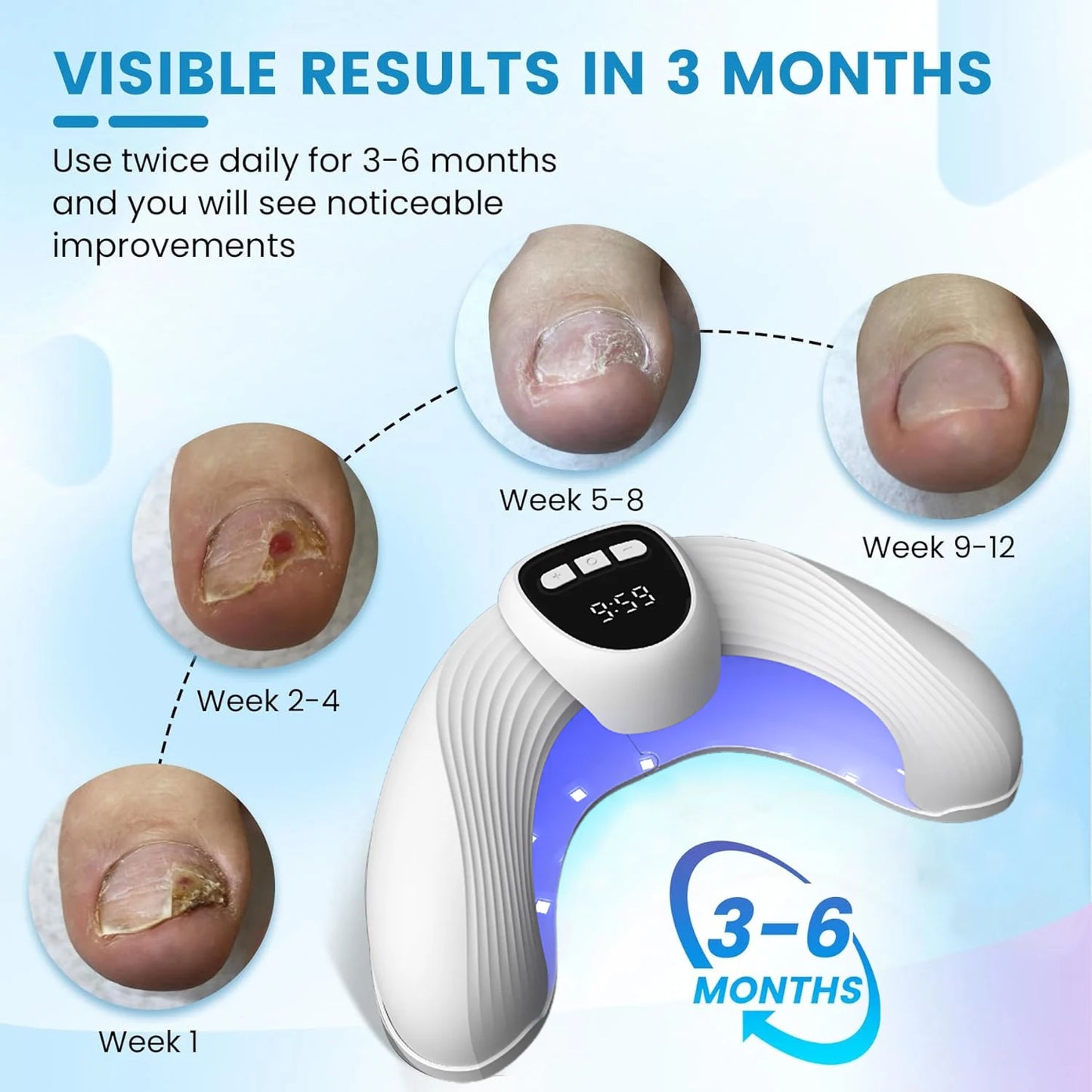 Led Nail Art Lamp Auto On Effectively Remove Nail Fungal Light Fingernail Fungus Treat with Display Curing Lamp
