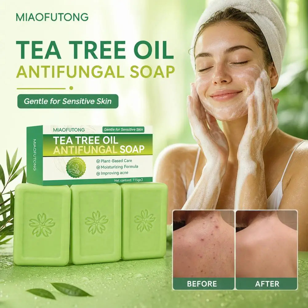 Tea Tree Soap for Face & Body Acne, 3pcs Tea Tree Oil Soap Bar for Face & Body Natural Skin Cleanser for Oily, Dry & Itchy Skin