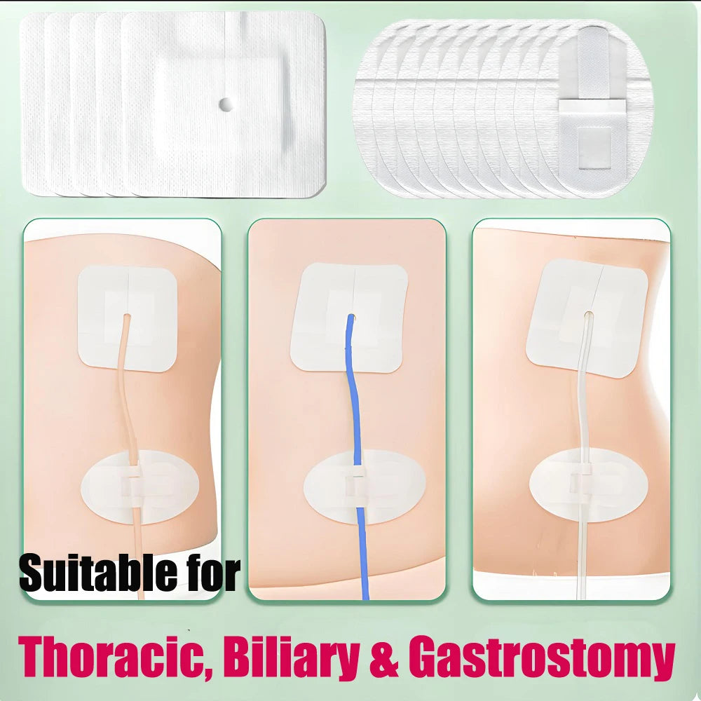 5-100Pcs Drainage Tube Sterile Applicator Catheter Fixation Patch for Drainage/Biliary/Renal Biopsy Catheters Adhesive Patch
