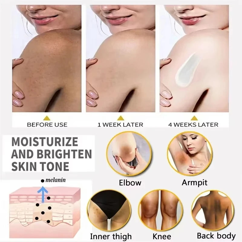 Body Whitening Soap Underarm Knee Bleaching Soap Chicken Skin Removal Dark Spot Removal Dead Skin Moisturize Brighten Body Care