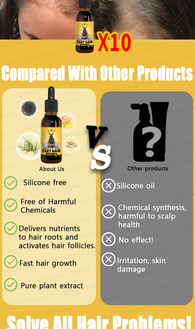 hair growth oil, Repair baldness, hairline, seborrheic alopecia hair care  fast shipping  hair oil
