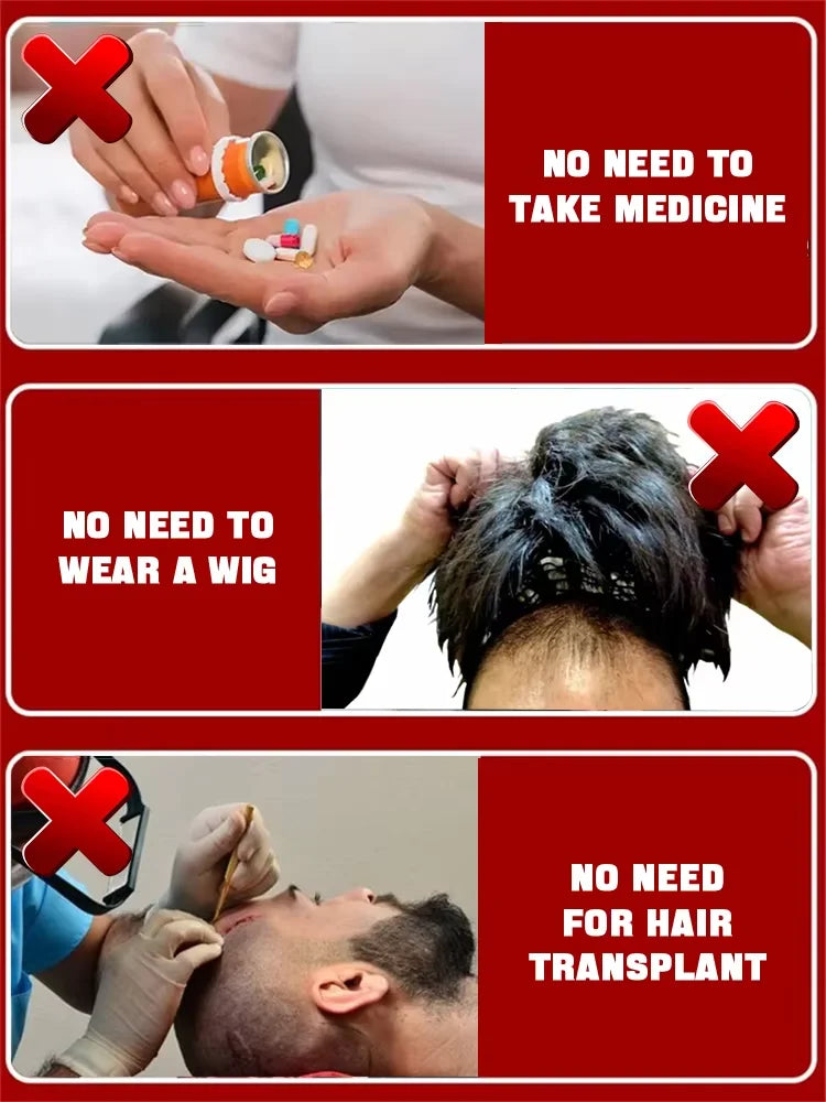 hair growth oil, Repair baldness, hairline, seborrheic alopecia hair care  fast shipping  hair oil