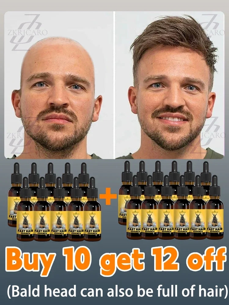 hair growth oil, Repair baldness, hairline, seborrheic alopecia hair care  fast shipping  hair oil