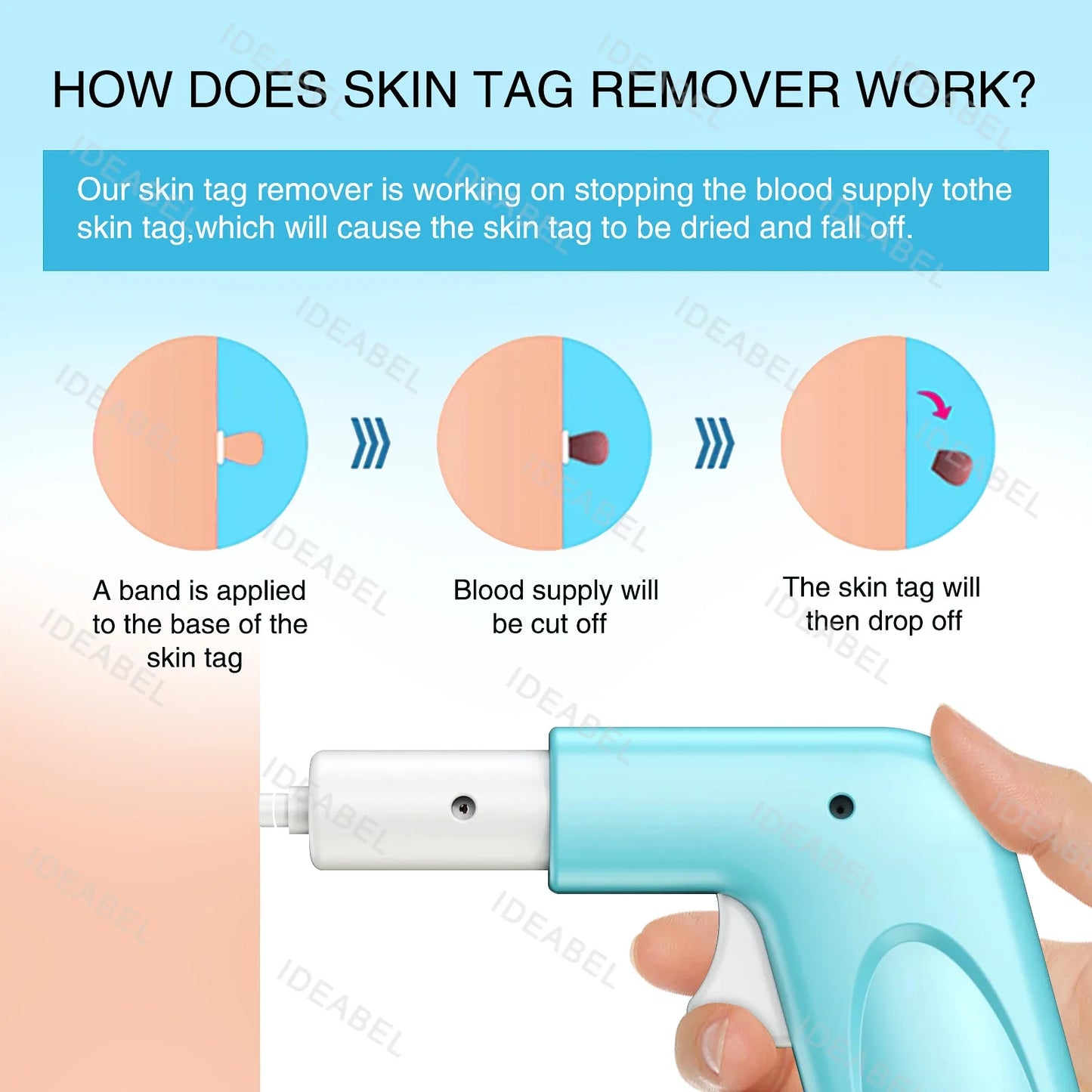 3 IN 1 Auto Micro Skin Tag Remover Device Standard And Micro Skin Tag Removal Kit Adult Mole Wart Remover Face Care Beauty Tools