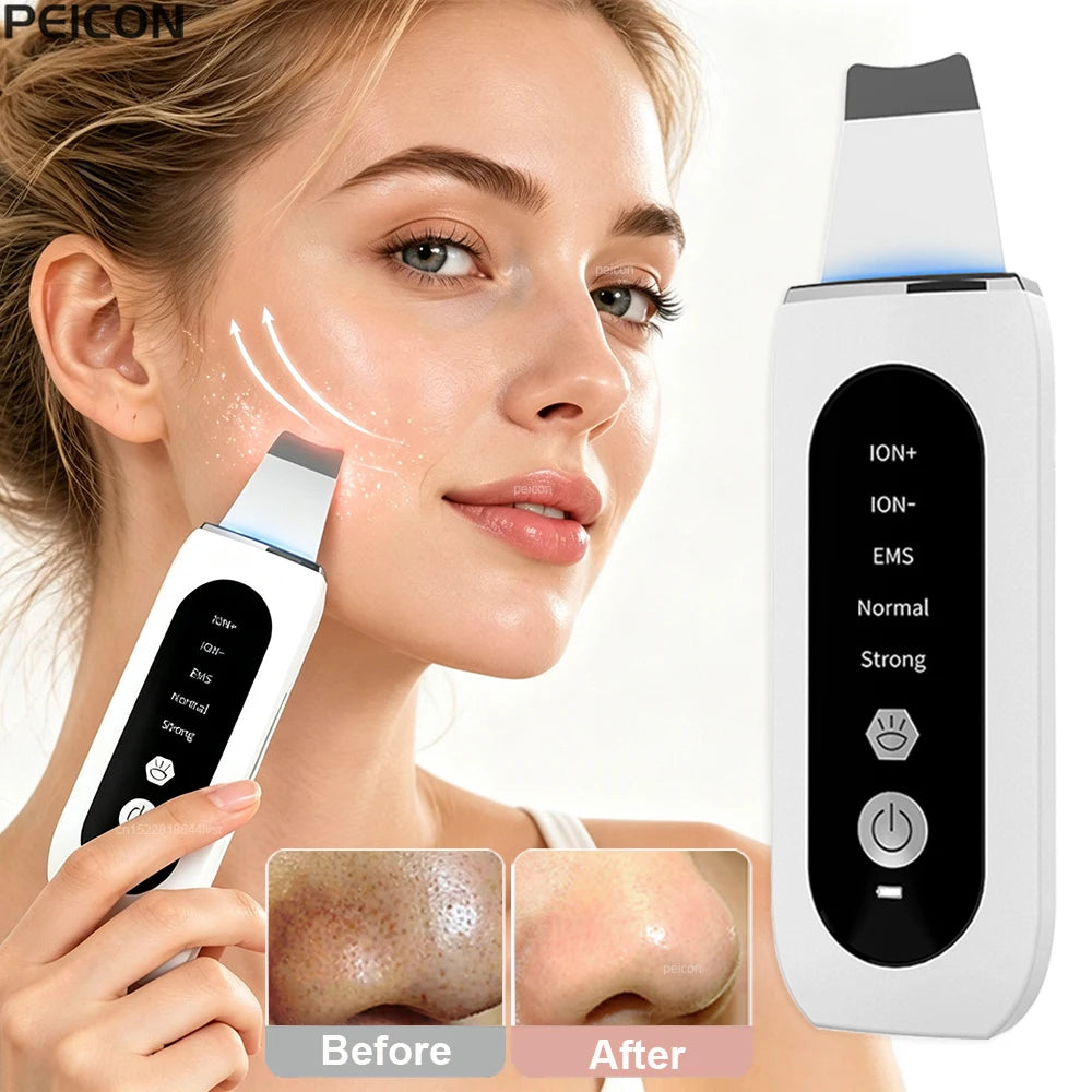 Ultrasonic Skin Scrubber Facial Peeling Machine Face Scrubber Acne Pore Deep Cleaning Facial Cleaning Spatula Blackhead Remover