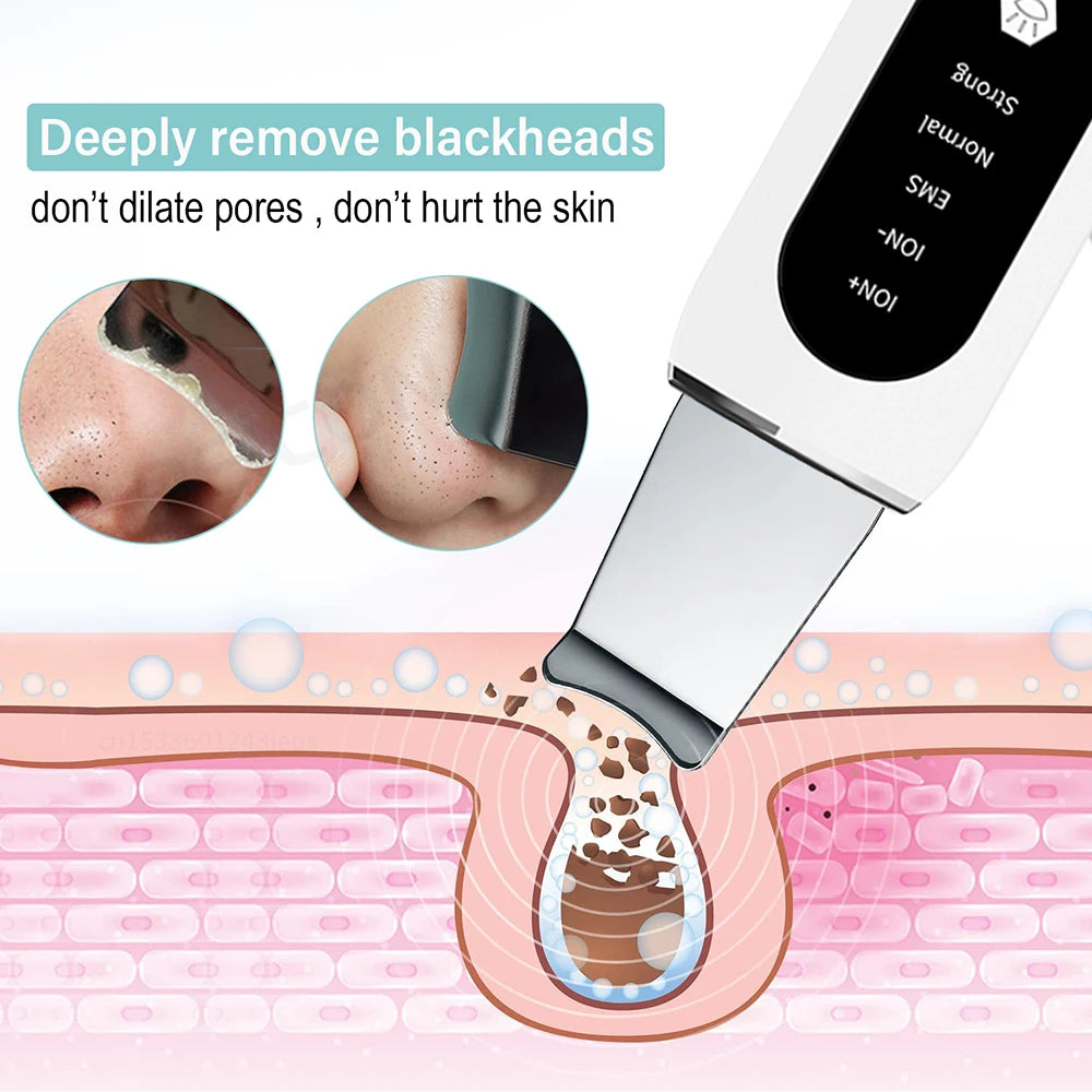 Ultrasonic Skin Scrubber Facial Peeling Machine Face Scrubber Acne Pore Deep Cleaning Facial Cleaning Spatula Blackhead Remover