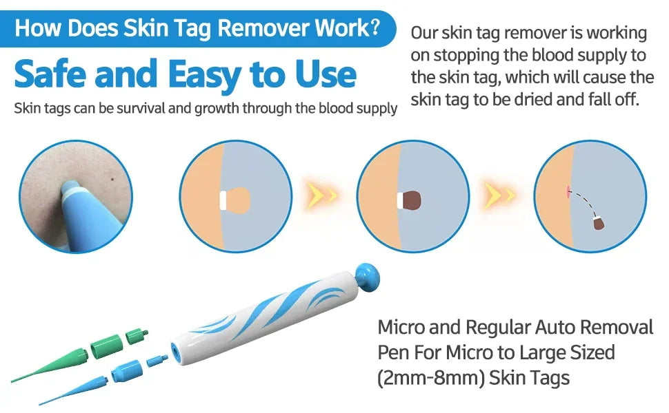 2 IN 1 Auto Micro Skin Tag Remover Device Standard And Micro Skin Tag Removal Kit Adult Mole Wart Remover Face Care Beauty Tools