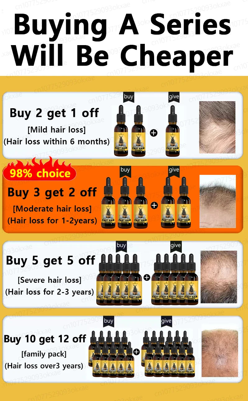 hair growth oil, Repair baldness, hairline, seborrheic alopecia hair care  fast shipping  hair oil