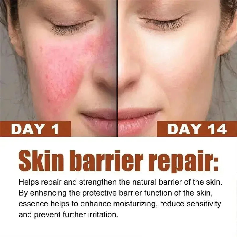 Facial Redness Repair Cream Improve Sensitive Skin Dryness Moisturizer Hydrating Sooth Lotion Removal Rosacea Korean Cosmetics
