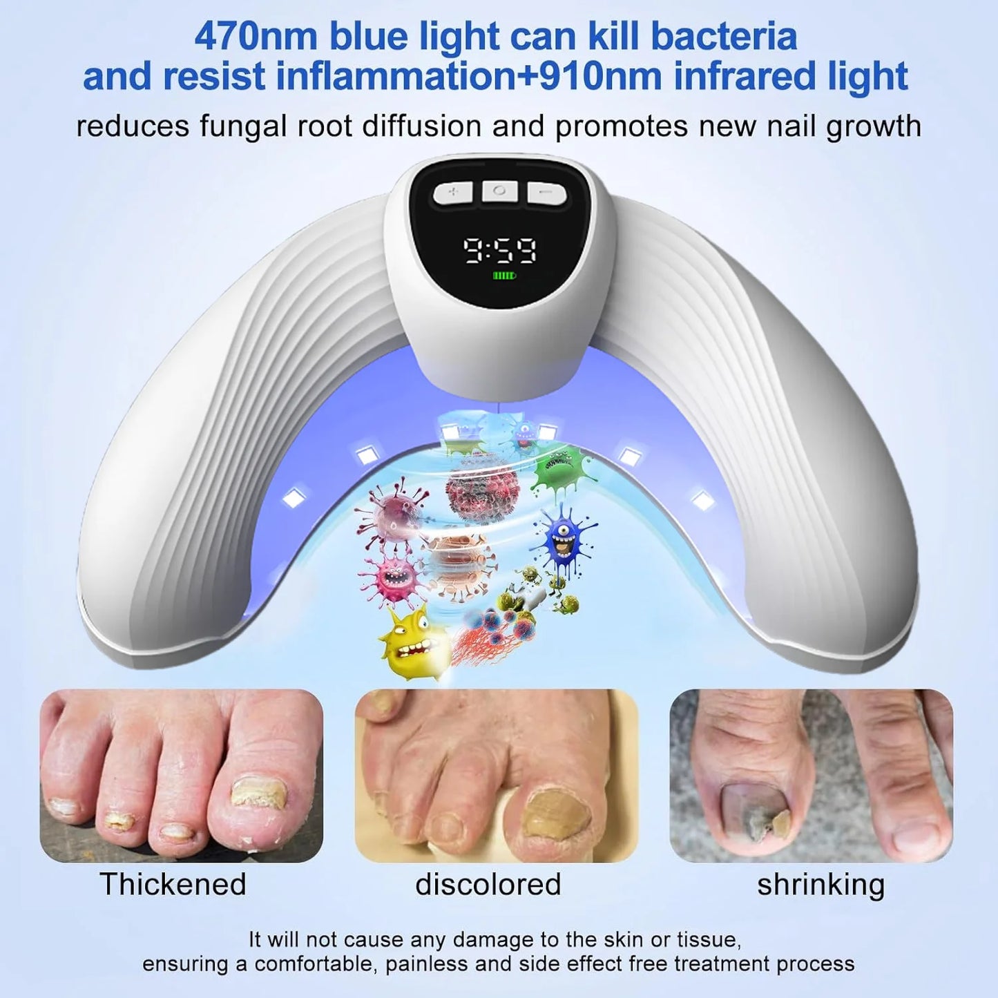Led Nail Art Lamp Auto On Effectively Remove Nail Fungal Light Fingernail Fungus Treat with Display Curing Lamp