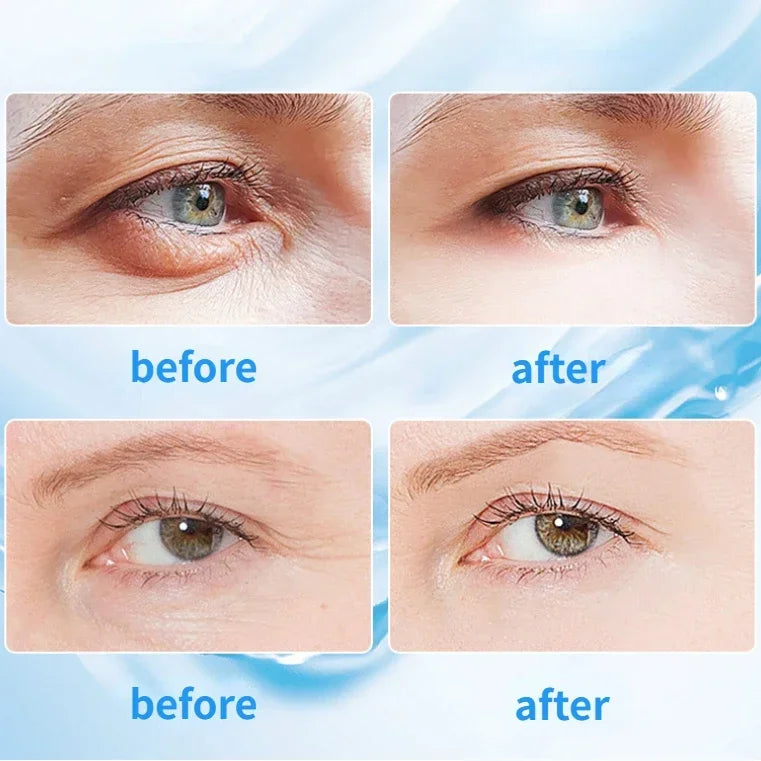 Nano Spray Eye Massage Instrument Facial Sprayer Humidifier USB Nebulizer Face Steamer Moisturizing Beauty Health Skin Care Tool