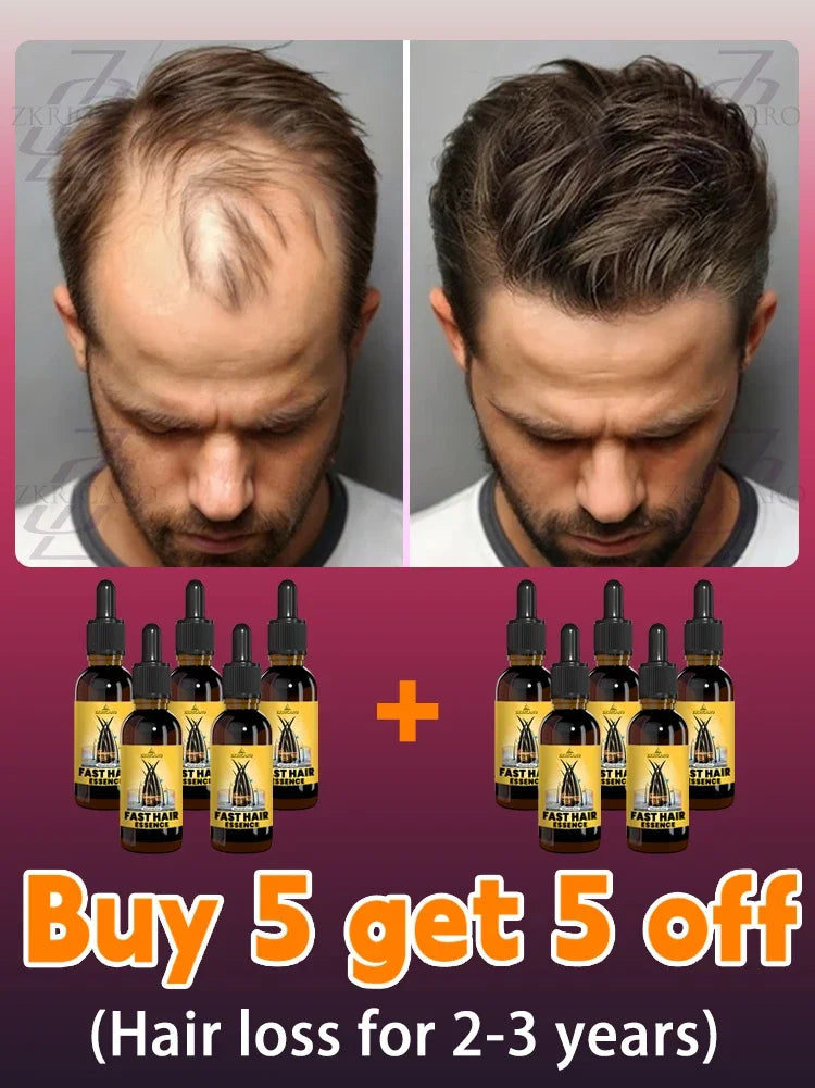 hair growth oil, Repair baldness, hairline, seborrheic alopecia hair care  fast shipping  hair oil