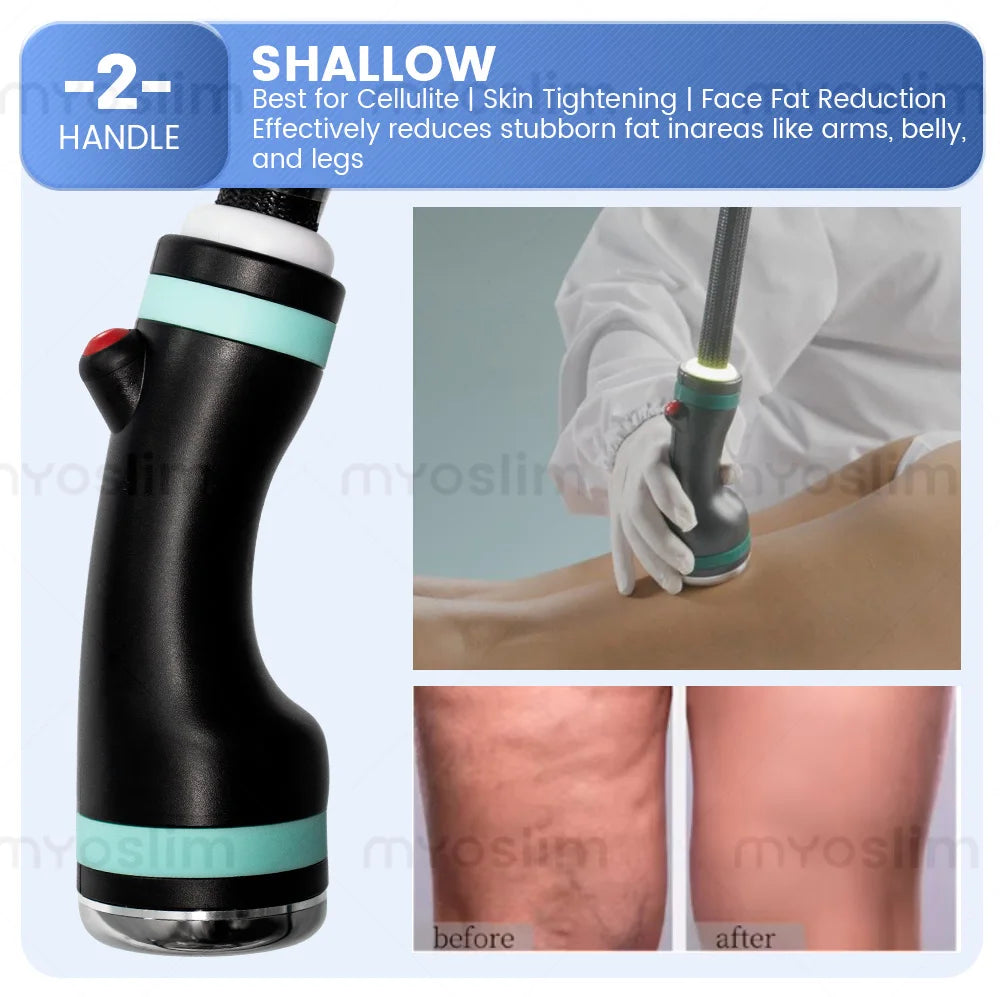 New Pro 3 Handles Micro Wave 80% Fat Reduction Safe Weight Loss Body Slimming Eliminate Double Chin Removal