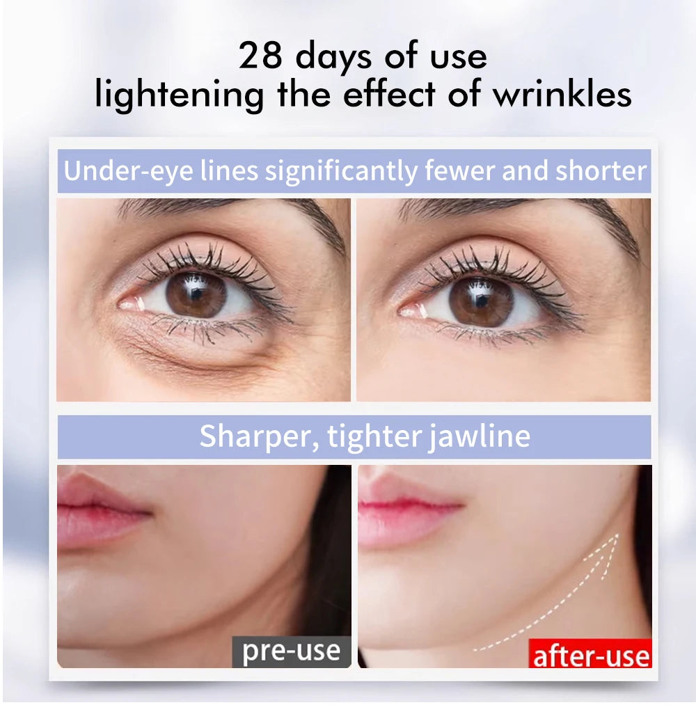 Beauty Eye Massager Device Red Light Facial Wand Eye Neck Massager Skin Tightening Anti Wrinkle SkinCare Beauty Anti Dark Circle