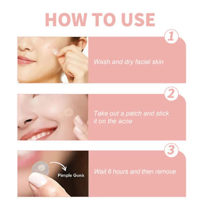 【Hot sales】72pcs Patches The Look Of Comedo And Invisible Concealer Breathable Covering Patch