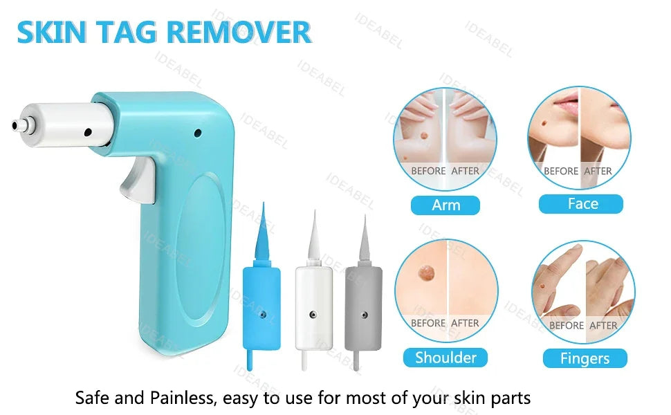 3 IN 1 Auto Micro Skin Tag Remover Device Standard And Micro Skin Tag Removal Kit Adult Mole Wart Remover Face Care Beauty Tools